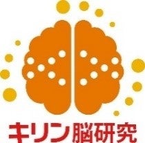 「ヨーロピアンシュガーコーン　華やぐ紅茶ラテ」を8月22日から新発売