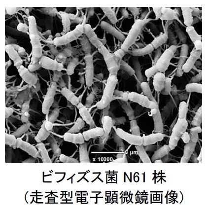 日清食品グループが保有する「ビフィズス菌N708株」が”ストレスによる下痢を軽減する” ことを発見!