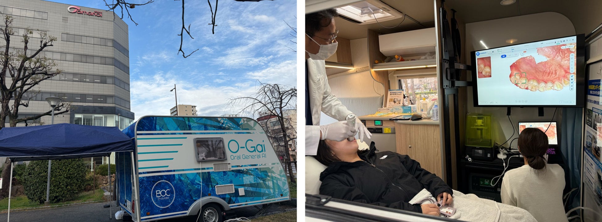 【実施レポート】「健康経営」を推進するタマノイ酢 オーガイ・堺市と連携し、移動型歯科検診の実証実験に参加